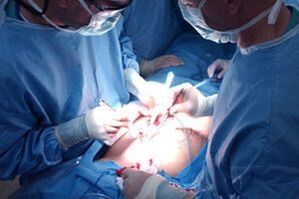 Performing an operation to increase penis